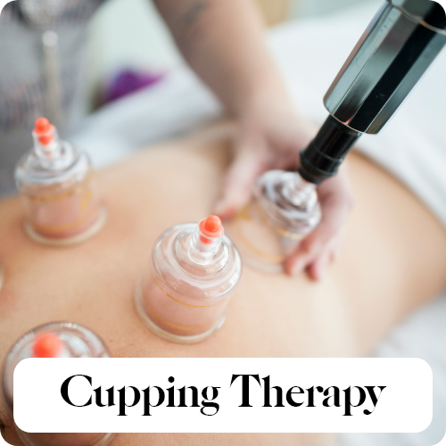 cupping therapy